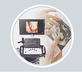 Prenatal diagnostikada ultratovush tekshiruvining ahamiyati